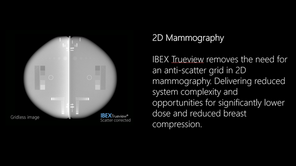 Gridless Scatter Correction in Mammography