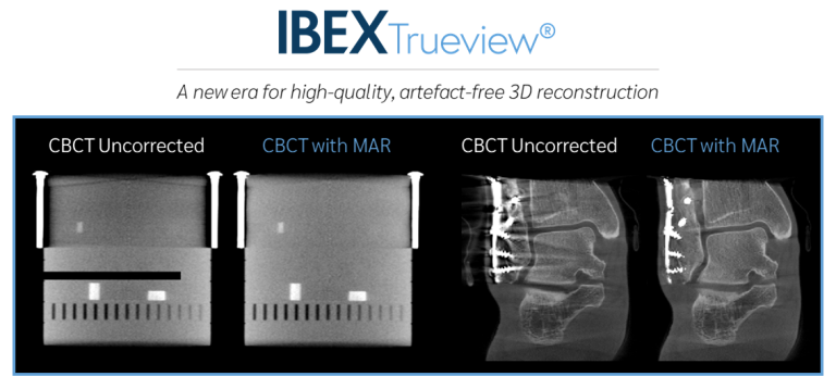 Advanced 3D Reconstruction Software for CBCT and DRT