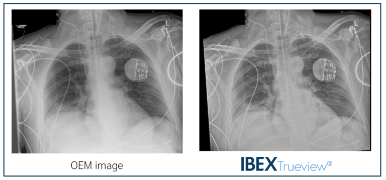 Enhanced Mobile Imaging in the Fast-Paced ITU Setting