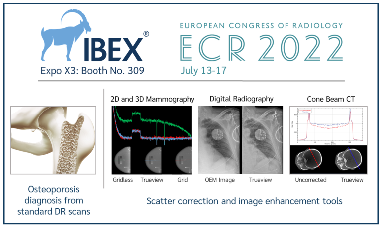 IBEX to exhibit latest advances in bone health diagnosis and image enhancement at ECR 2022