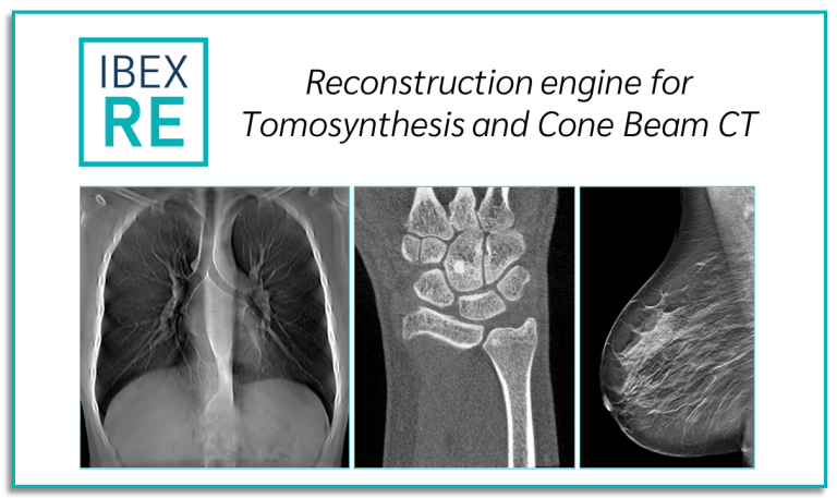 IBEX RE – Reconstruction engine for Tomosynthesis and Cone Beam CT