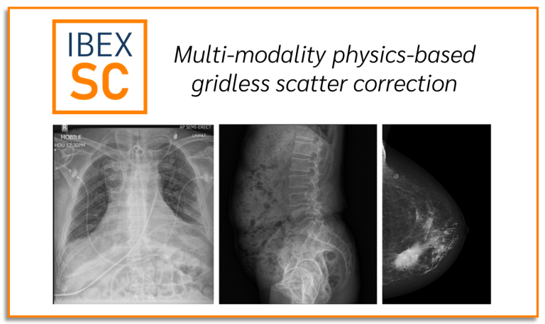 IBEX SC – Multi-modality physics-based gridless scatter correction