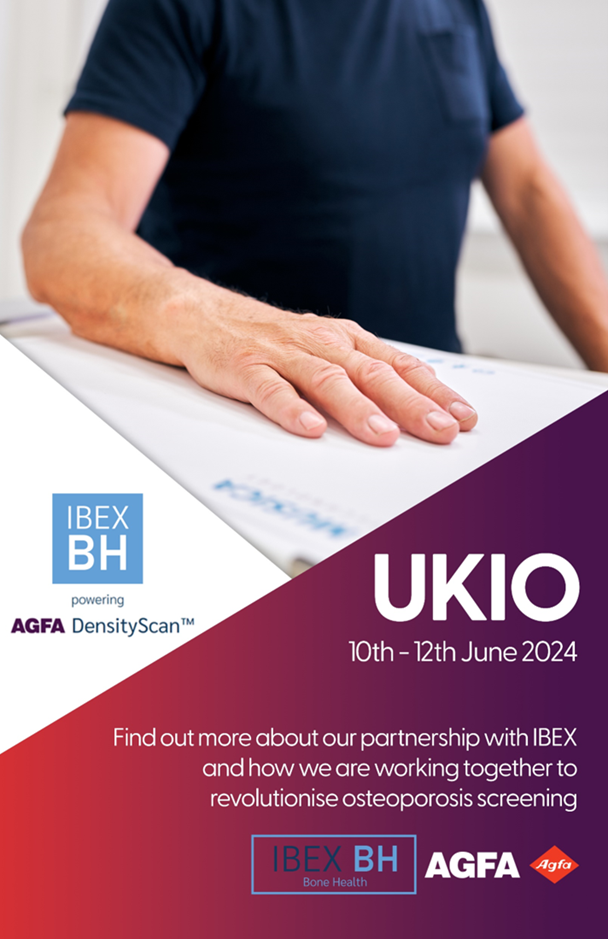 Agfa Radiology are launching DensityScan powered by IBEX BH for UK sale on 10th June